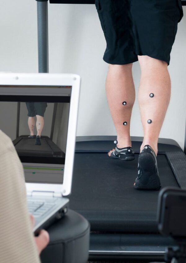 Foto van iemand op een loopband die gemonitord wordt tijdens een bewegingsanalyse bij de podoloog